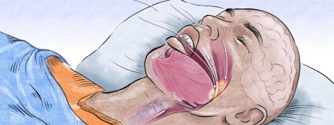 The Effects Sleep Apnea Has on Work Performance - Imagup