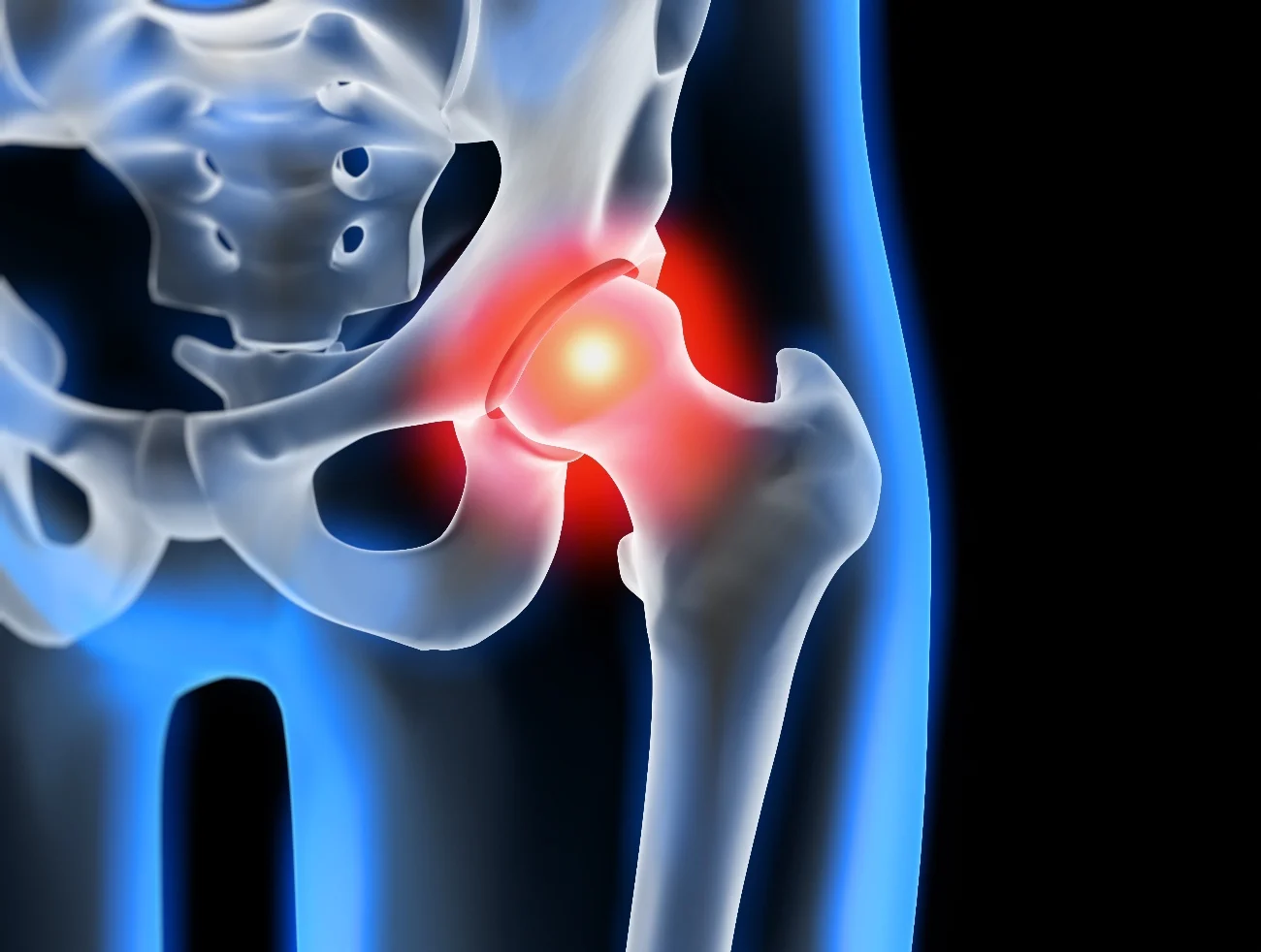 5 Best Chairs for Hip Osteoarthritis in 2024 Imagup