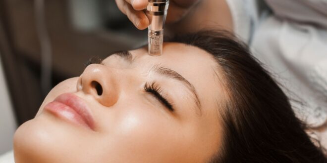 Exploring the Growing Trend of Microneedling What You Need to Know