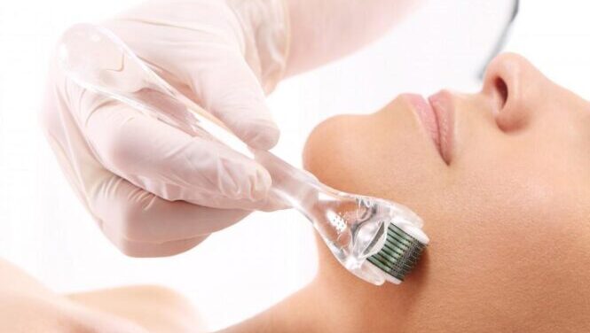 Microneedling Newtown PA